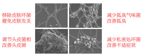 景岳副干酪乳杆菌SCP益生菌之皮肤功效及应